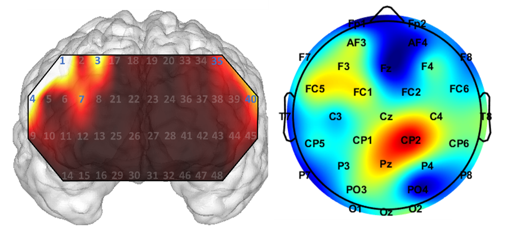 Clinical Feature Identification via XAI